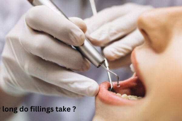 how long do fillings take