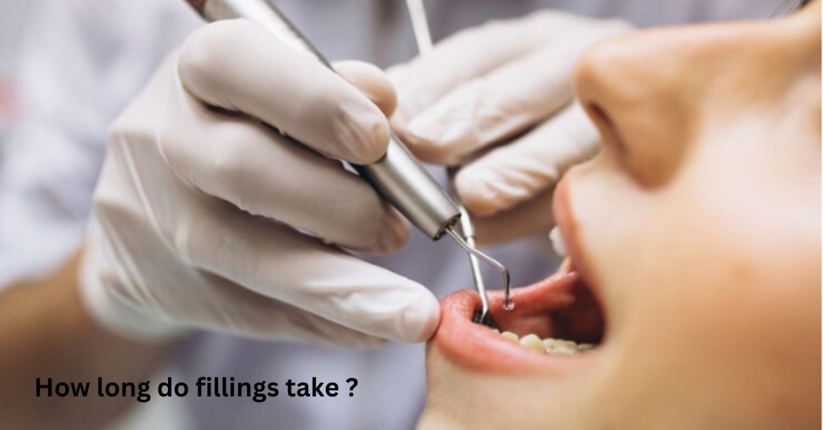 how long do fillings take